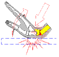 See this wrist injury point sample